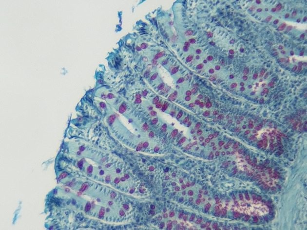 Simple Columnar Epithelium Slides - Simple Columnar Epithelium 04 100X